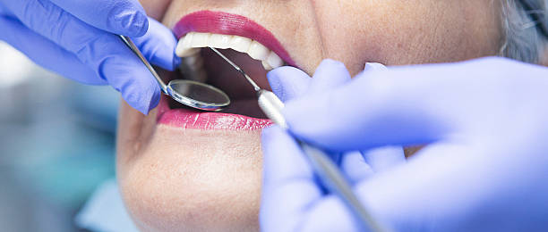 Best Emergency Tooth Extraction in Roy, UT